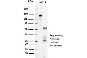 SDS-PAGE Analysis Purified p57 Recombinant Rabbit Monoclonal Antibody (KIP2/7083R). (Rekombinanter CDKN1C Antikörper)
