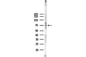 Western blot analysis of lysates from Hela cells(LPS 4h treatment), using Phospho-DRP1 (Ser637) Antibody at 1/1000 dilution.