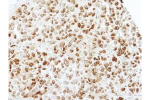 Immunohistochemistry (IHC) image for anti-TAF15 RNA Polymerase II, TATA Box Binding Protein (TBP)-Associated Factor, 68kDa (TAF15) (Center) antibody (ABIN2855557)