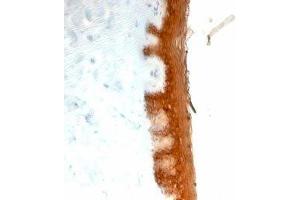 Formalin-fixed, paraffin-embedded human skin stained with Keratin 10 antibody (KRT10/844). (Keratin 10 Antikörper)
