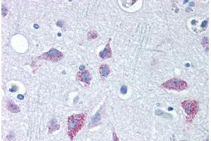 Human Brain, Cortex (formalin-fixed, paraffin-embedded) stained with WNT8B antibody ABIN351424 at 10 ug/ml followed by biotinylated goat anti-rabbit IgG secondary antibody ABIN481713, alkaline phosphatase-streptavidin and chromogen. (WNT8B Antikörper  (Internal Region))
