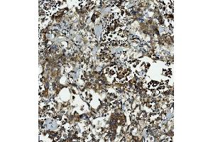 IHC analysis of Caspase-5/CASP5 using anti-Caspase-5/CASP5 antibody (ABIN7599992).