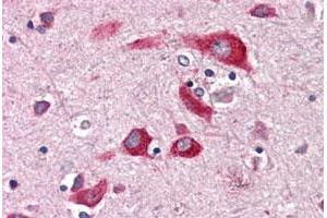 Immunohistochemical staining of human brain, cortex with ENTPD2 polyclonal antibody . (ENTPD2 Antikörper  (Internal Region))
