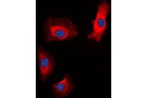 Immunofluorescent analysis of Amylin staining in HeLa cells. (Amylin/DAP Antikörper  (N-Term))