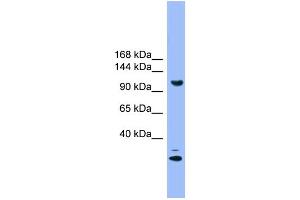 WB Suggested Anti-STARD8 Antibody Titration: 1.