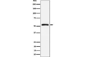 Western blot analysis of CAP1 expression in Raji cell lysate. (Rekombinanter CAP1 Antikörper)