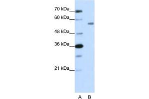 Western Blotting (WB) image for anti-Zinc Finger Protein 497 (ZNF497) antibody (ABIN2462019) (ZNF497 Antikörper)