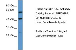 Western Blotting (WB) image for anti-G Protein-Coupled Receptor, Family C, Group 5, Member B (GPRC5B) (N-Term) antibody (ABIN2788217)