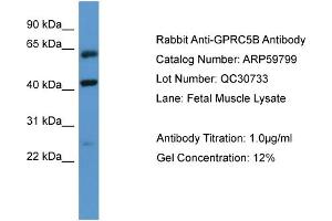 WB Suggested Anti-GPRC5B  Antibody Titration: 0.
