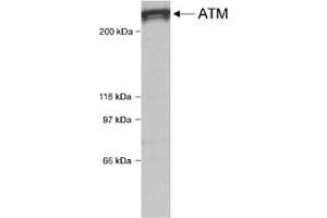 Western blot analysis of ATM in HeLa whole cell lysate using ATM polyclonal antibody . (ATM Antikörper  (C-Term))