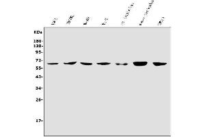 Western blot analysis of RIOK1/RIO1 using anti-RIOK1/RIO1 antibody (ABIN7599108).
