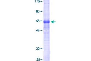 Image no. 1 for Podoplanin (PDPN) (AA 1-238) protein (GST tag) (ABIN1314581)