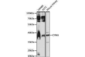 Western blot analysis of extracts of various cell lines, using CYR61 antibody (ABIN1872182) at 1:1000 dilution. (CYR61 Antikörper)