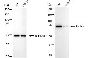 Western blotting analysis using Radixin antibody (ABIN7800123).