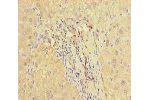 Immunohistochemistry of paraffin-embedded human liver tissue using ABIN7166464 at dilution of 1:100