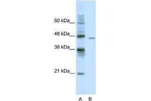 WB Suggested Anti-DDX25 Antibody Titration:  0. (DDX25 Antikörper  (C-Term))