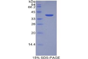 SDS-PAGE analysis of Human LEAP2 Protein. (Liver Expressed Antimicrobial Peptide 2 (LEAP2) Peptid)