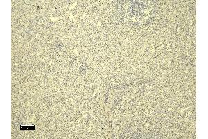 Immunohistochemistry (IHC) image for anti-Ionized Calcium-binding Adapter Molecule 1 (IBA1) (C-Term) antibody (ABIN184738)