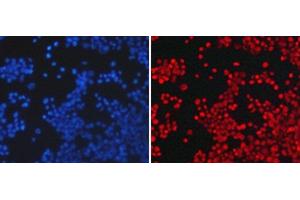 Immunofluorescence analysis of 293T cells using Asymmetric DiMethyl-Histone H3-R26 Polyclonal Antibody (Histone 3 Antikörper  (H3R26me2a))