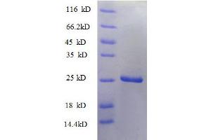 SDS-PAGE (SDS) image for Tumor Necrosis Factor (Ligand) Superfamily, Member 9 (TNFSF9) (AA 52-254), (partial) protein (His tag) (ABIN1046589)