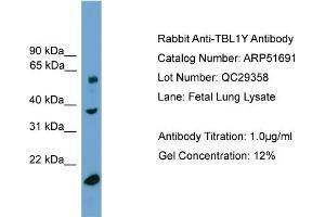 WB Suggested Anti-TBL1Y  Antibody Titration: 0.