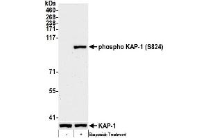 Western Blotting (WB) image for anti-Tripartite Motif Containing 28 (TRIM28) (pSer824) antibody (ABIN7455183)