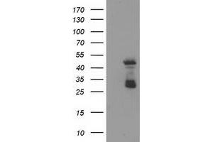 Western Blotting (WB) image for anti-ELK3, ETS-Domain Protein (SRF Accessory Protein 2) (ELK3) antibody (ABIN1498005) (ELK3 Antikörper)