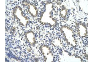 Rabbit Anti-ZNF274 antibody         Paraffin Embedded Tissue:  Human Lung    cell Cellular Data:  alveolar cell    Antibody Concentration:  4. (ZNF274 Antikörper  (Middle Region))