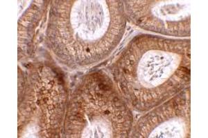 Immunohistochemistry of SPINK2 in mouse testis tissue with SPINK2 antibody at 2. (SPINK2 Antikörper  (C-Term))