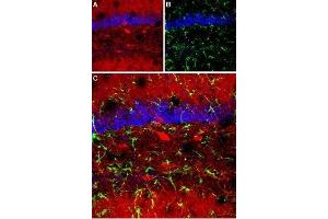 Expression of GABRA1 in mouse hippocampusImmunohistochemical staining of mouse hippocampus using Anti-GABA(A) α1 Receptor (extracellular) Antibody (ABIN7043183, ABIN7044295 and ABIN7044296). (gamma-aminobutyric Acid (GABA) A Receptor, alpha 1 (GABRA1) Peptid)