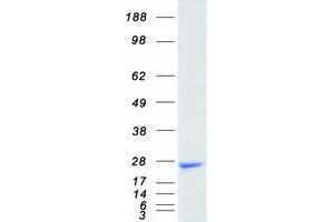 Western Blotting (WB) image for HRas proto-oncogene, GTPase (HRAS) (Transcript Variant 1) protein (Myc-DYKDDDDK Tag) (ABIN2723050)