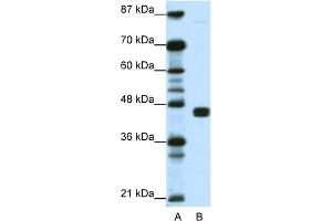 WB Suggested Anti-PPARG Antibody Titration:  1. (PPARG Antikörper  (N-Term))