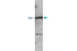Western blot analysis of extracts from NB4 cells using PML polyclonal antibody . (PML Antikörper)