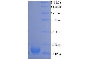 SDS-PAGE (SDS) image for phospholipase A2, Group V (PLA2G5) (AA 21-138) protein (His tag) (ABIN5713736) (PLA2G5 Protein (AA 21-138) (His tag))
