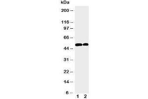 Western blot testing of NOXA1 antibody and Lane 1:  U87;  2: HeLa cell lysate. (NOXA1 Antikörper  (Middle Region))