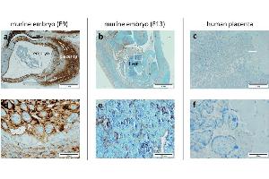 Immunohistochemical staining of PlGF in paraffin-embedded mouse placenta embryo (a and b) showing intense cytoplasmic staining in mouse placenta at E9. (PLGF Antikörper  (AA 24-158))