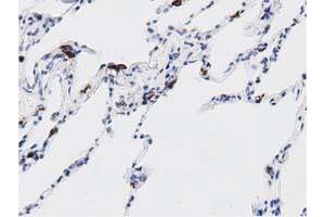 Immunohistochemistry (IHC) image for anti-DnaJ (Hsp40) Homolog, Subfamily A, Member 2 (DNAJA2) antibody (ABIN1497859) (DNAJA2 Antikörper)
