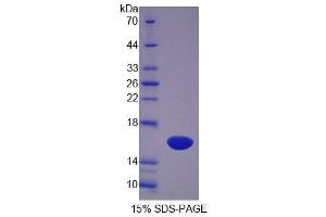 SDS-PAGE (SDS) image for Sterol Carrier Protein 2 (SCP2) (AA 433-547) protein (His tag) (ABIN6239204)