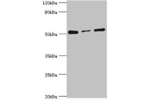Western blot All lanes: Programmed cell death protein 4 antibody at 4 μg/mL Lane 1: Hela whole cell lysate Lane 2: MCF-7 whole cell lysate Lane 3: Jurkat whole cell lysate Secondary Goat polyclonal to rabbit IgG at 1/10000 dilution Predicted band size: 52, 51 kDa Observed band size: 52 kDa (PDCD4 Antikörper  (AA 1-260))