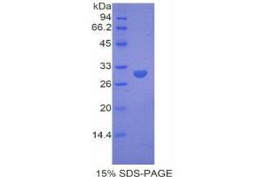 SDS-PAGE (SDS) image for Dystrophin (DMD) (AA 3059-3314) protein (His tag) (ABIN1878298)