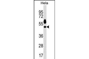 Western Blotting (WB) image for anti-serum/glucocorticoid Regulated Kinase 1 (SGK1) (AA 323-352), (C-Term) antibody (ABIN1537130)