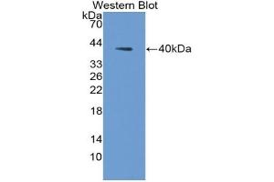 Detection of Recombinant AQP2, Human using Polyclonal Antibody to Aquaporin 2, Collecting Duct (AQP2) (AQP2 Antikörper  (AA 177-271))