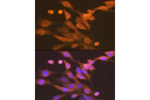 Immunofluorescence analysis of NIH-3T3 cells using Xanthine Oxidase (XDH) (XDH) Rabbit mAb (ABIN7271408) at dilution of 1:100 (40x lens). (XDH Antikörper)