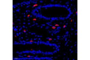 Immunofluorescence of paraffin embedded human colon using Annexin-A8 (ABIN7073071) at dilution of 1: 3866 (400x lens) (Annexin VIII Antikörper)