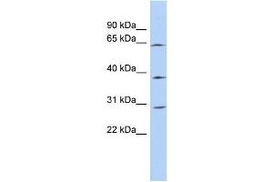 WB Suggested Anti-CCDC54 Antibody Titration: 0.