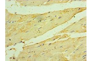 Immunohistochemistry of paraffin-embedded human skeletal muscle tissue using ABIN7154912 at dilution of 1:100 (HSPB2 Antikörper  (AA 1-182))