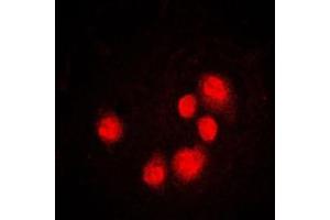 Immunofluorescent analysis of GADD153 staining in MCF7 cells. (DDIT3 Antikörper  (Center))
