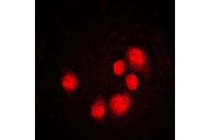 Immunofluorescent analysis of GADD153 staining in MCF7 cells.