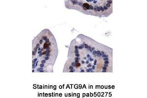 Image no. 2 for anti-ATG9 Autophagy Related 9 Homolog A (S. Cerevisiae) (ATG9A) (AA 750-839), (C-Term) antibody (ABIN363584) (ATG9A Antikörper  (C-Term))