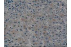 IHC-P analysis of Human Liver Tissue, with DAB staining. (Tissue factor Antikörper  (AA 34-251))